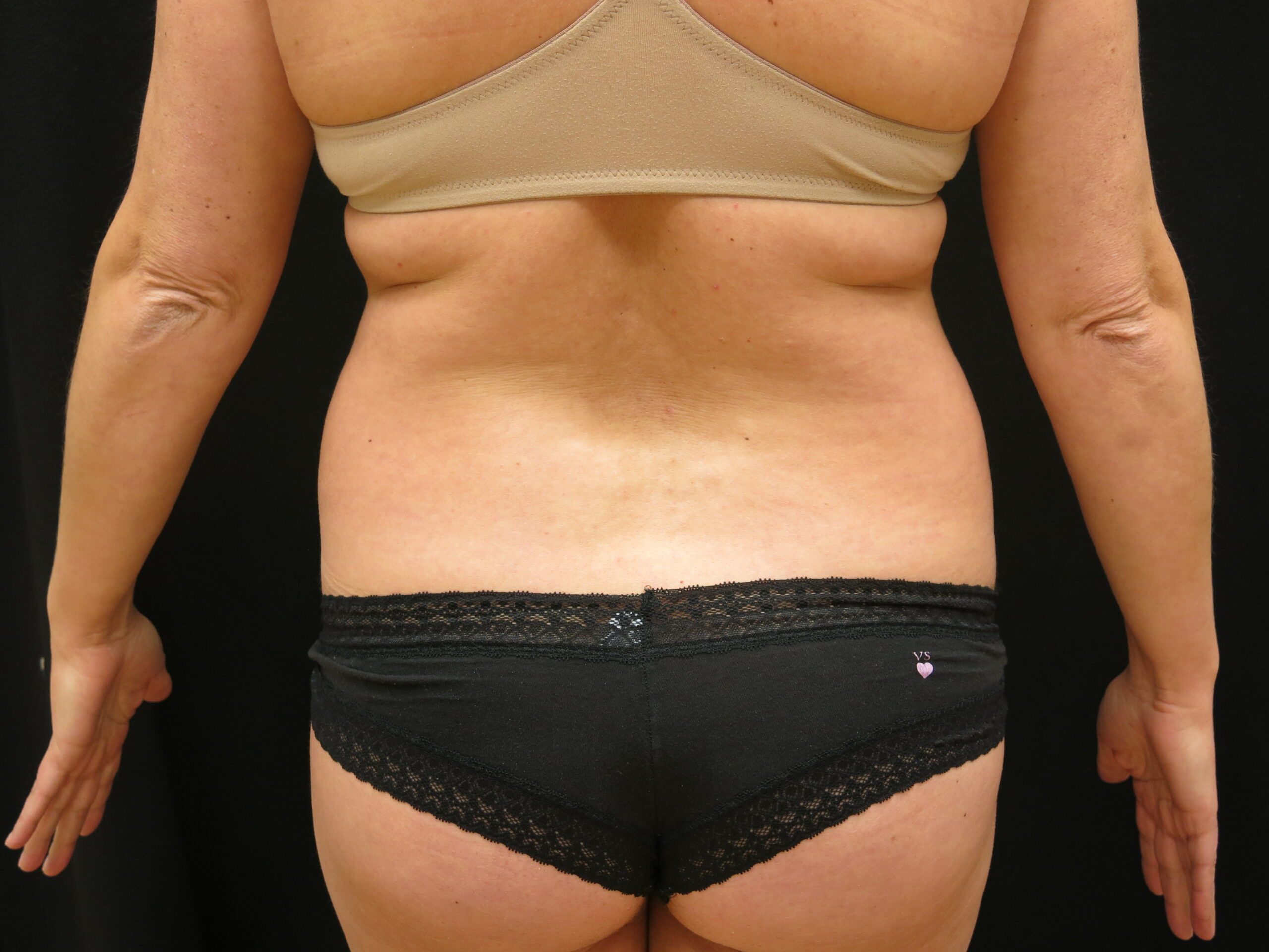 Back view of a person wearing a burgundy lace thong, with the lower back exposed against a dark background.