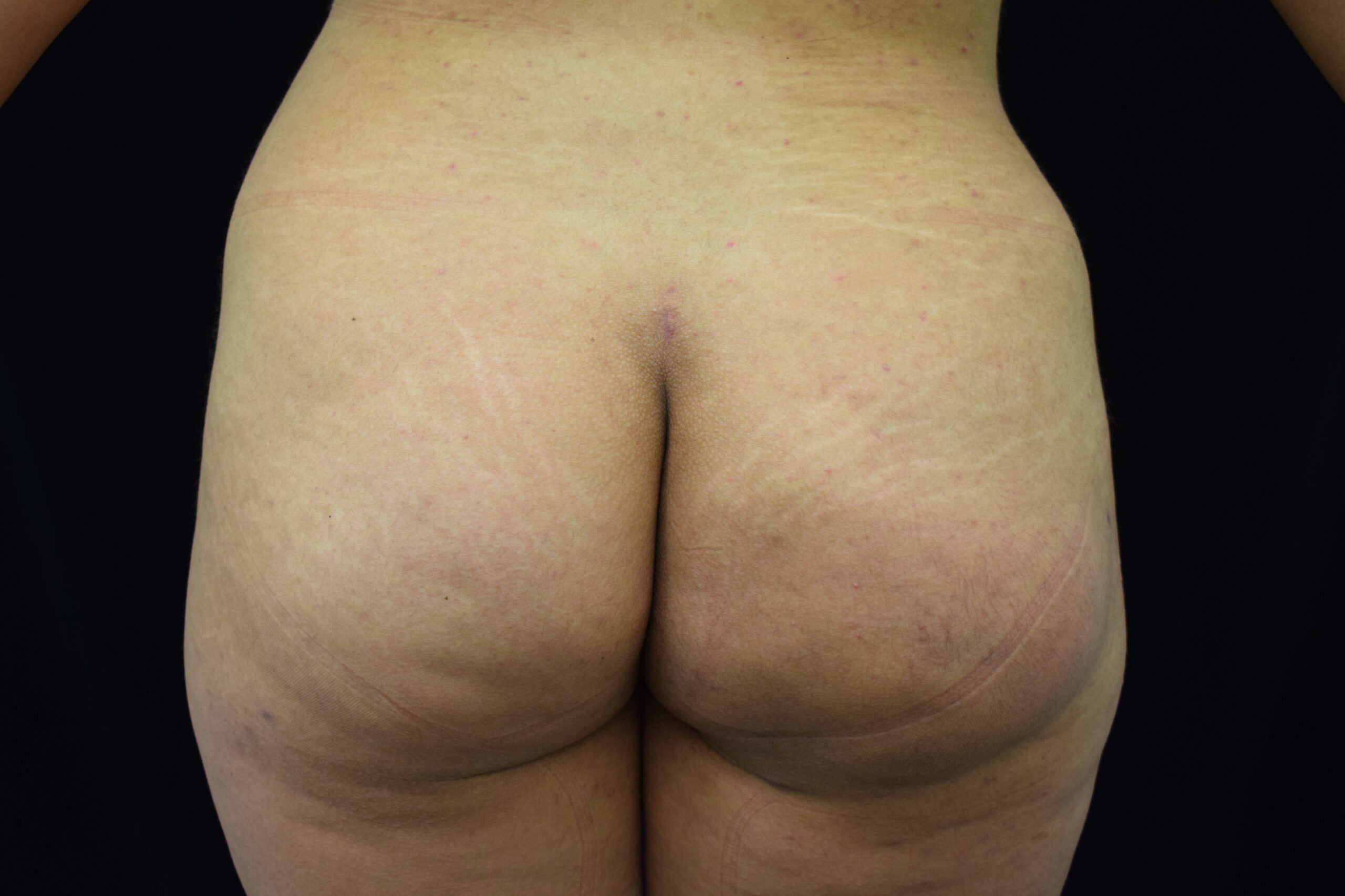 Back view of a person wearing black lace underwear, showing lower back and upper buttocks against a dark background.