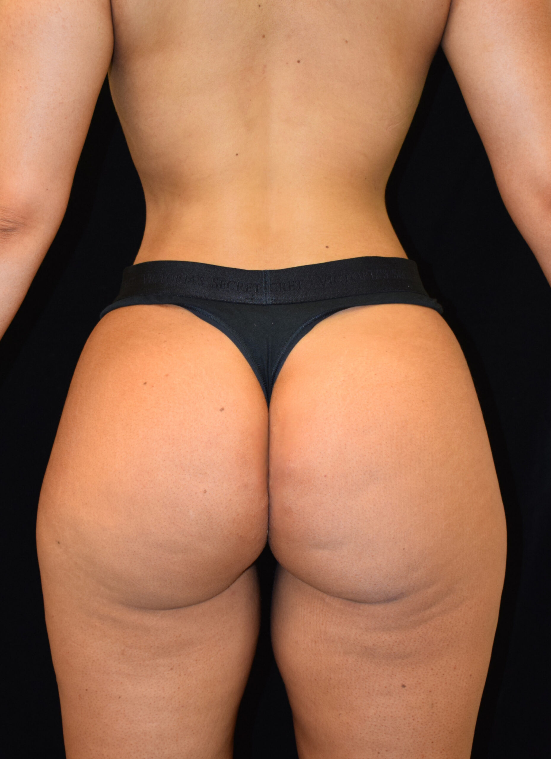 Back view of a person wearing black lace underwear, showing lower back and upper buttocks against a dark background.