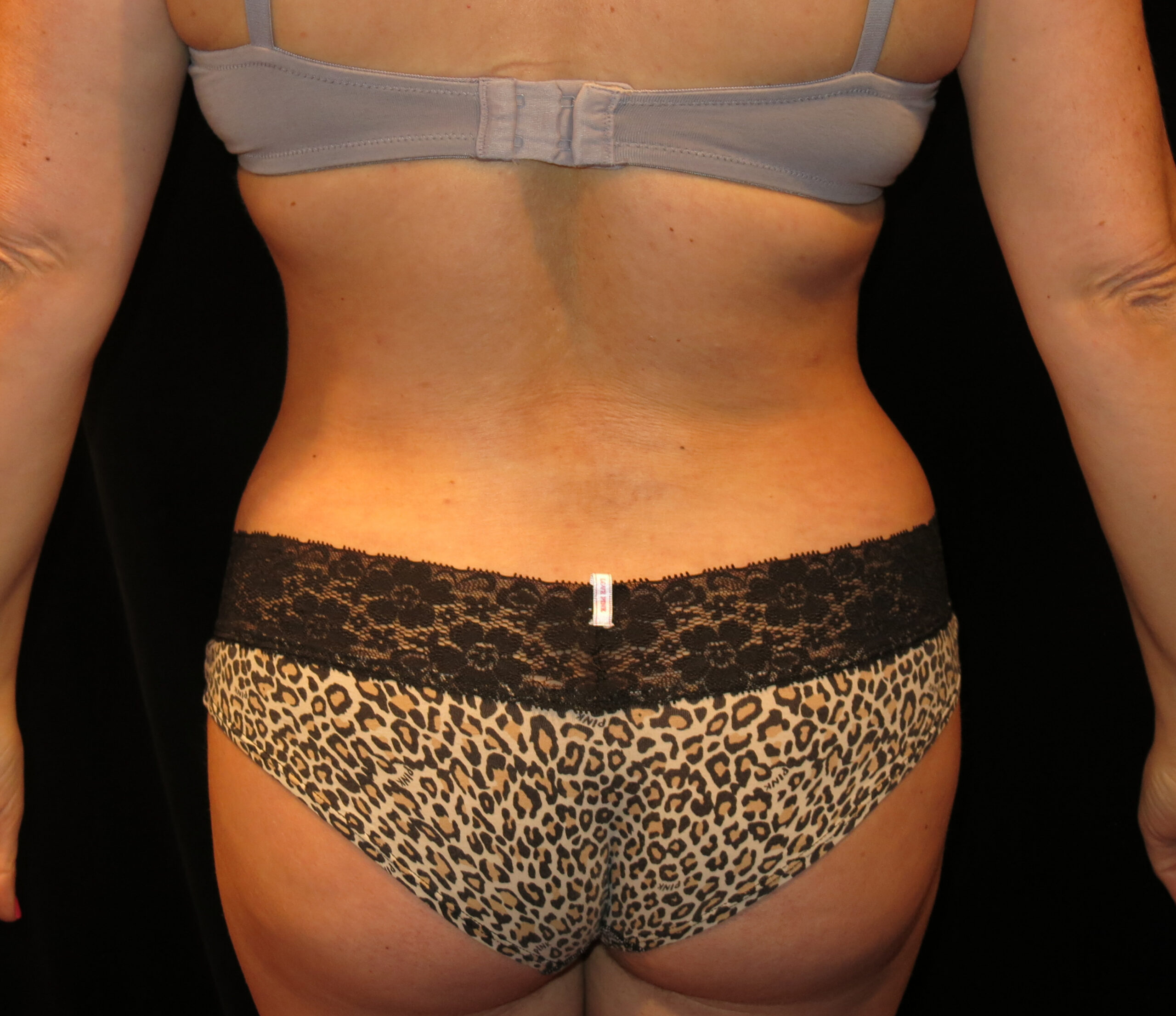 Back view of a person wearing black lace underwear, showing lower back and upper buttocks against a dark background.