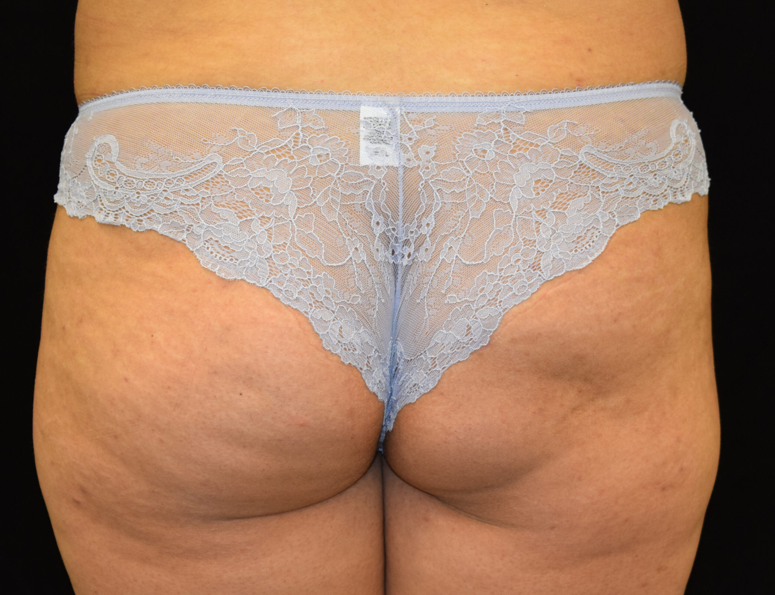 Back view of a person wearing a burgundy lace thong, with the lower back exposed against a dark background.