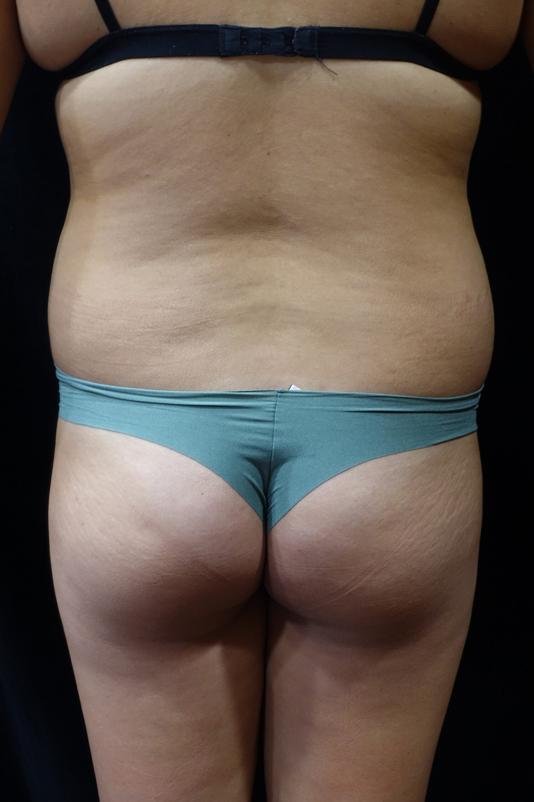 Back view of a person wearing a burgundy lace thong, with the lower back exposed against a dark background.
