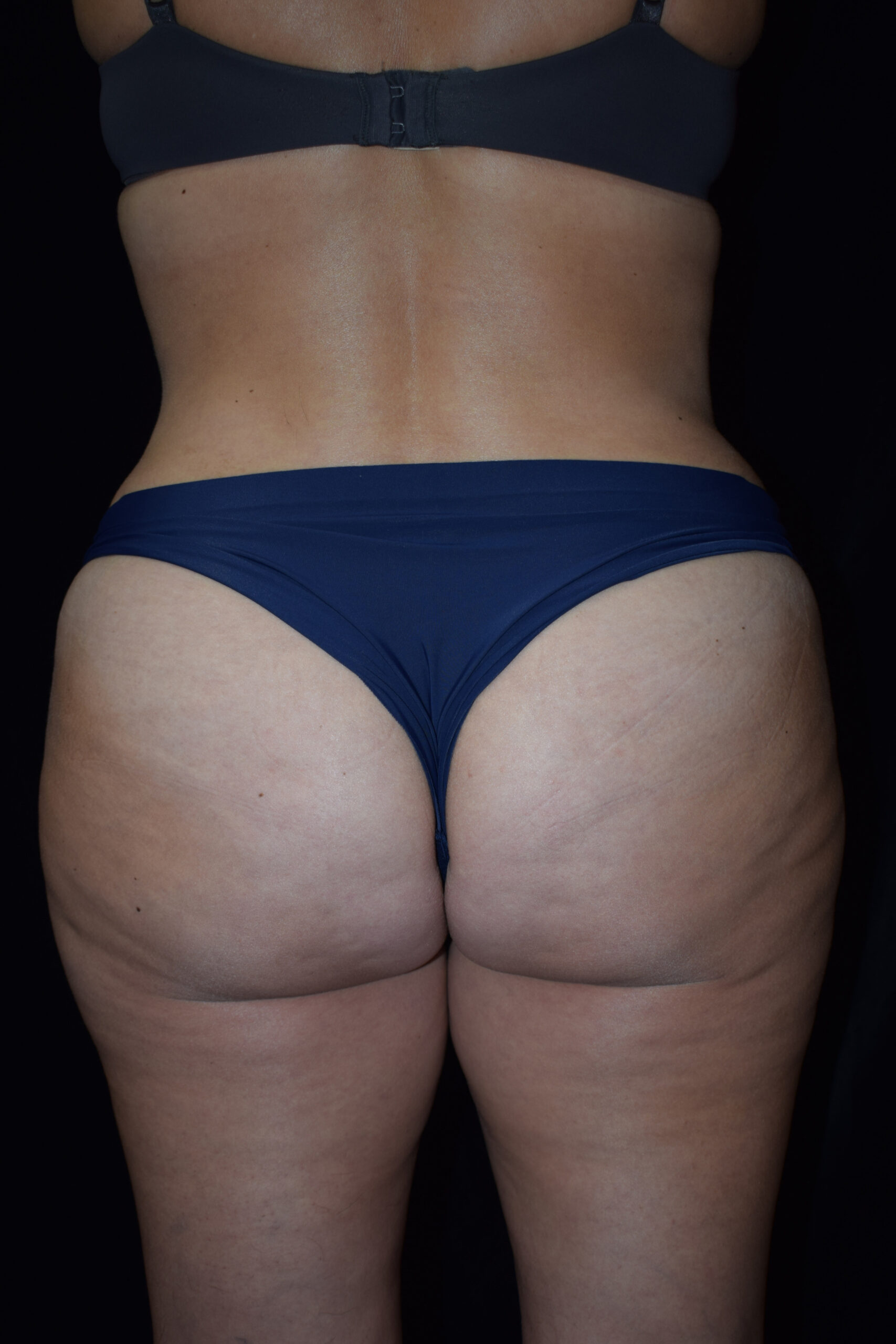 Back view of a person wearing black lace underwear, showing lower back and upper buttocks against a dark background.