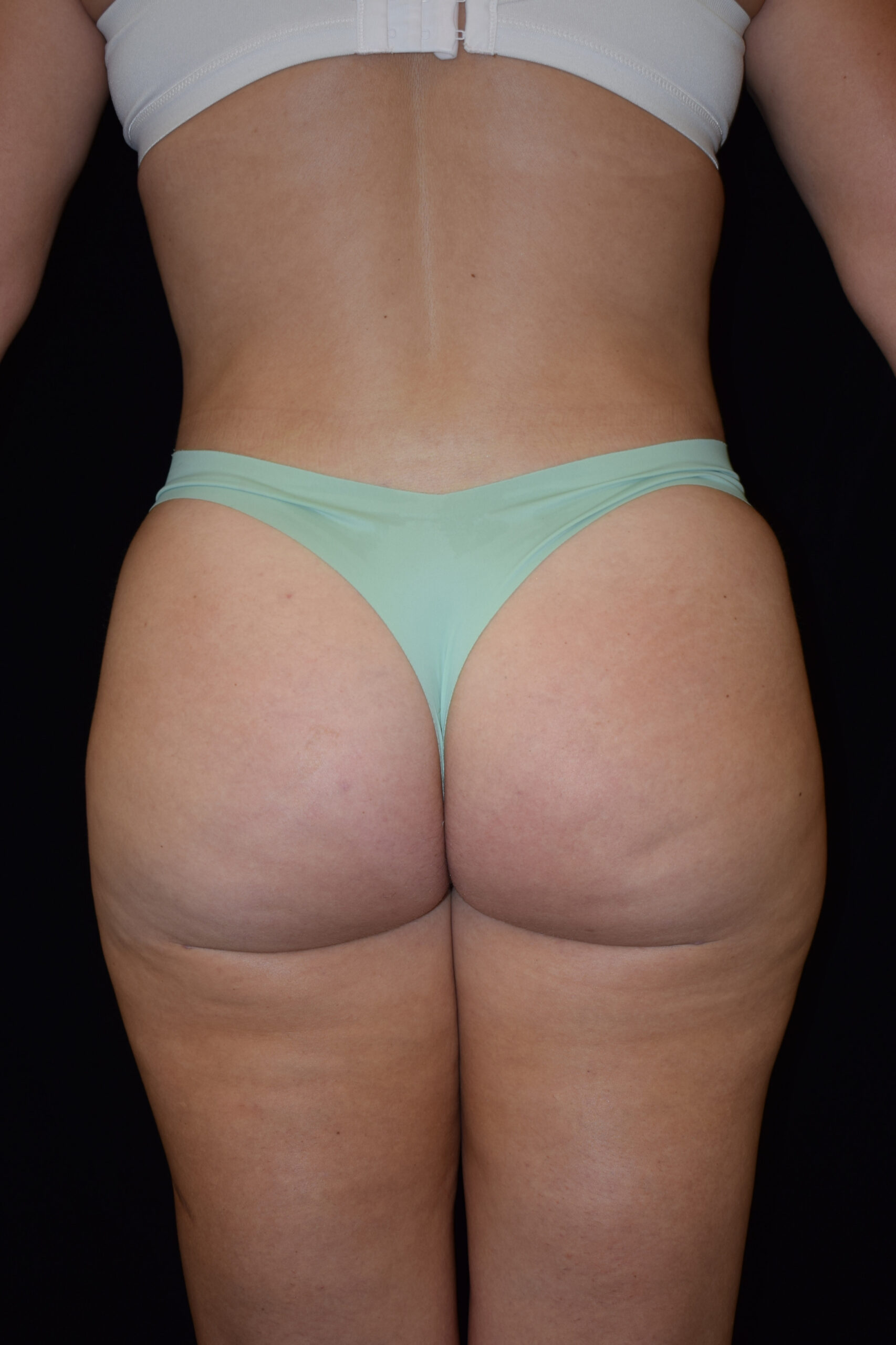 Back view of a person wearing beige lace underwear against a dark background.