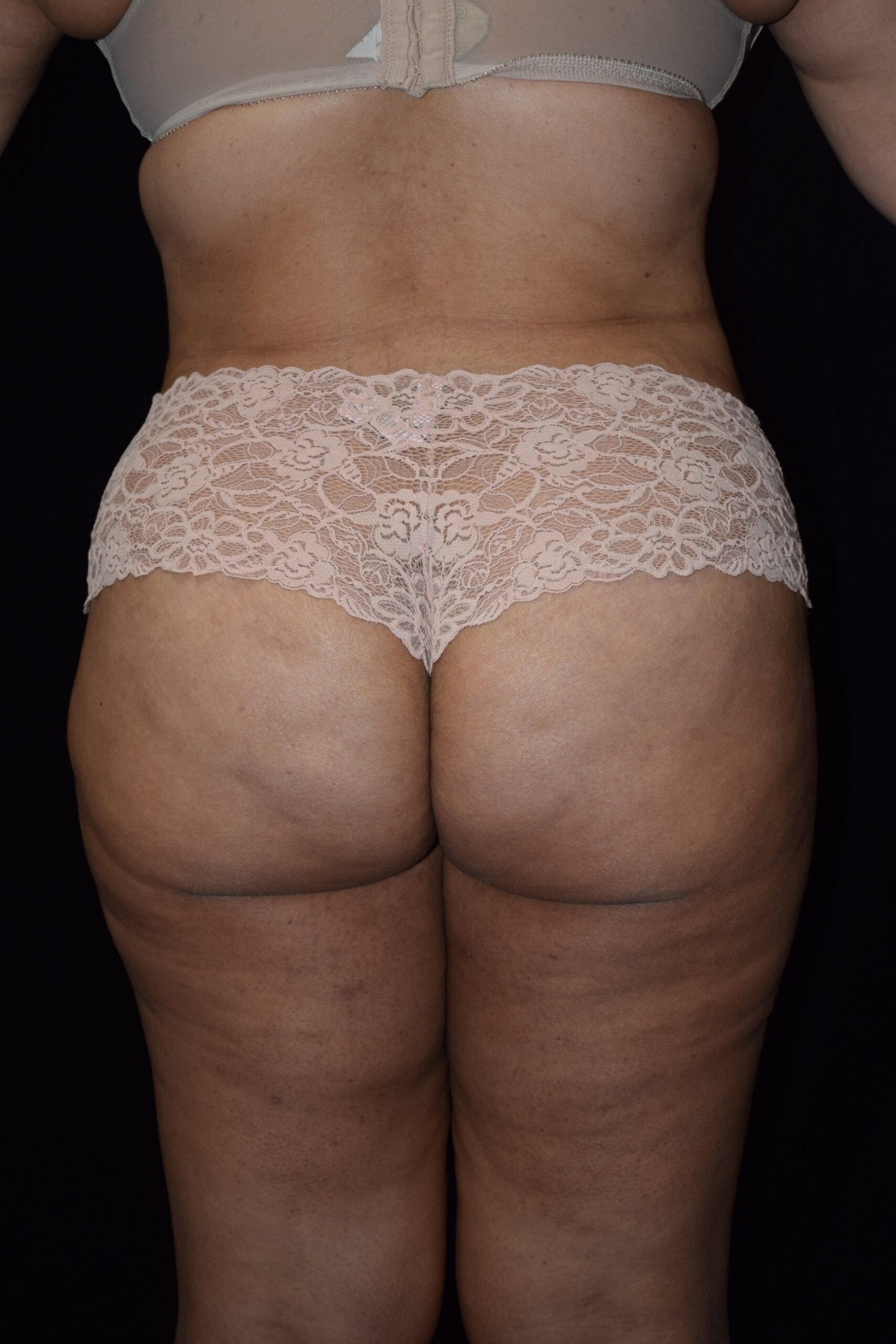 Back view of a person wearing beige lace underwear against a dark background.