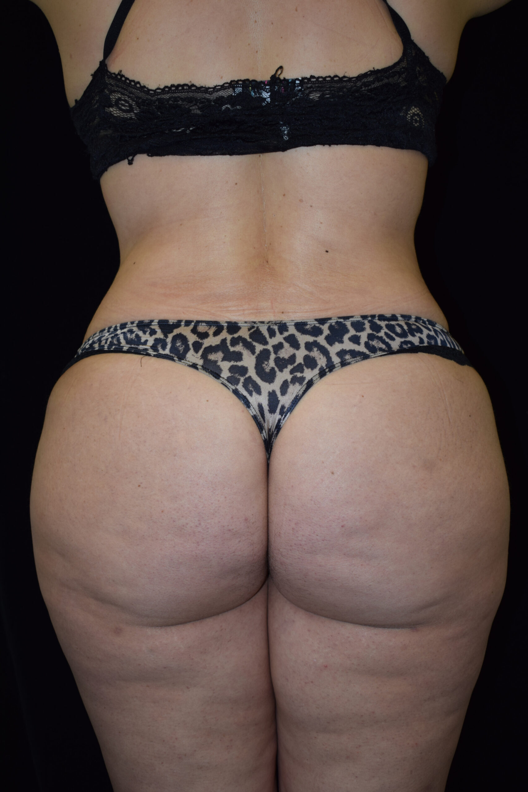 Back view of a person wearing a black bra and lace underwear, standing against a dark background.