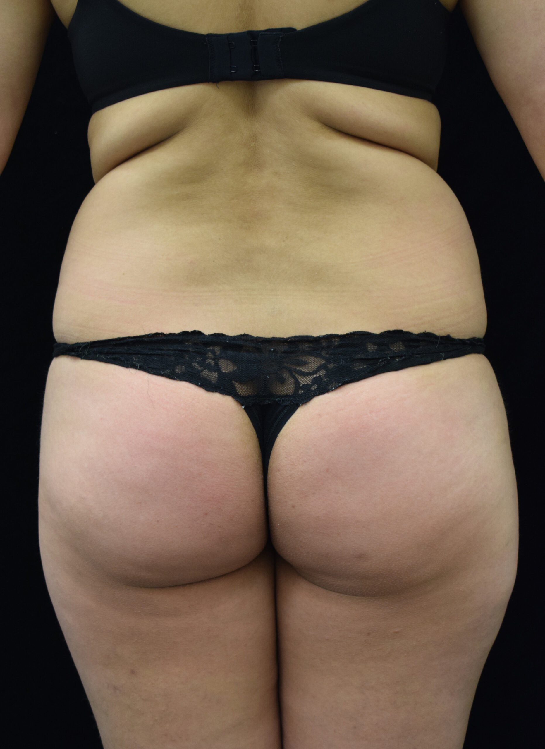 Rear view of a person wearing a lime green top and a white Calvin Klein waistband, exposing the lower back and buttocks.