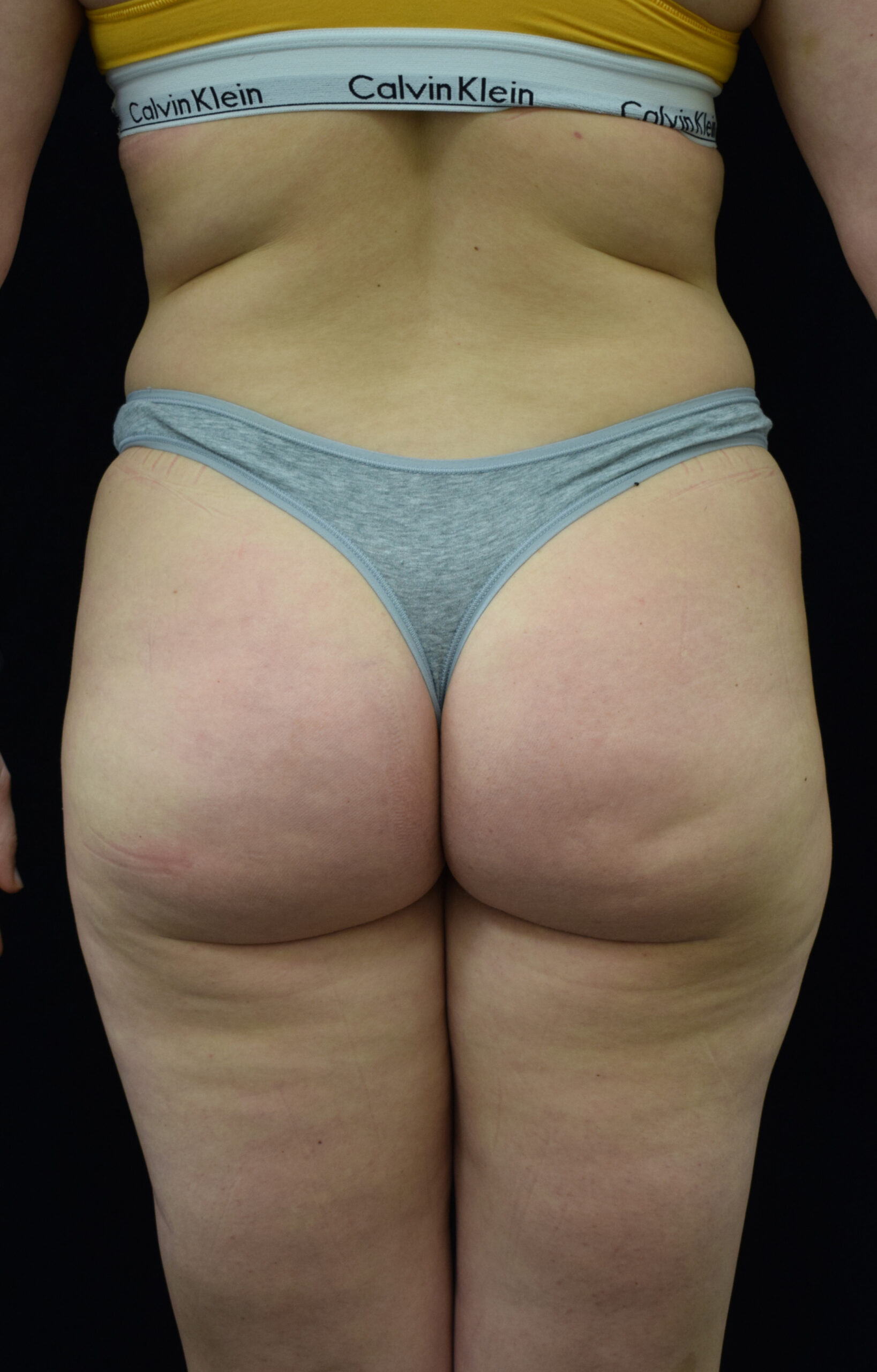 Back view of a person wearing a yellow sports bra and light gray underwear, showing mid-back and hips against a dark background.