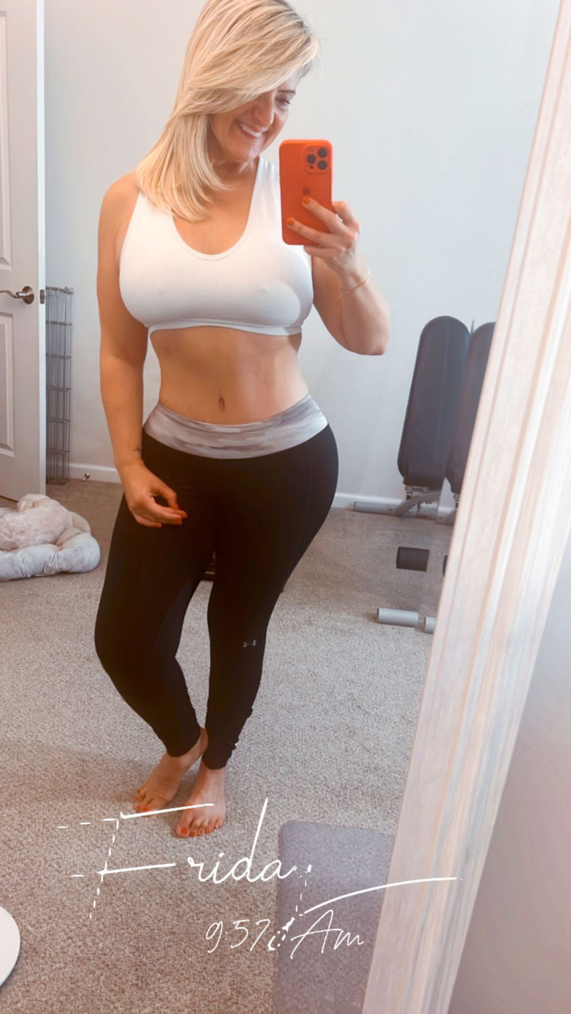 happy smiling female after abdominoplasty surgery in workout outfit